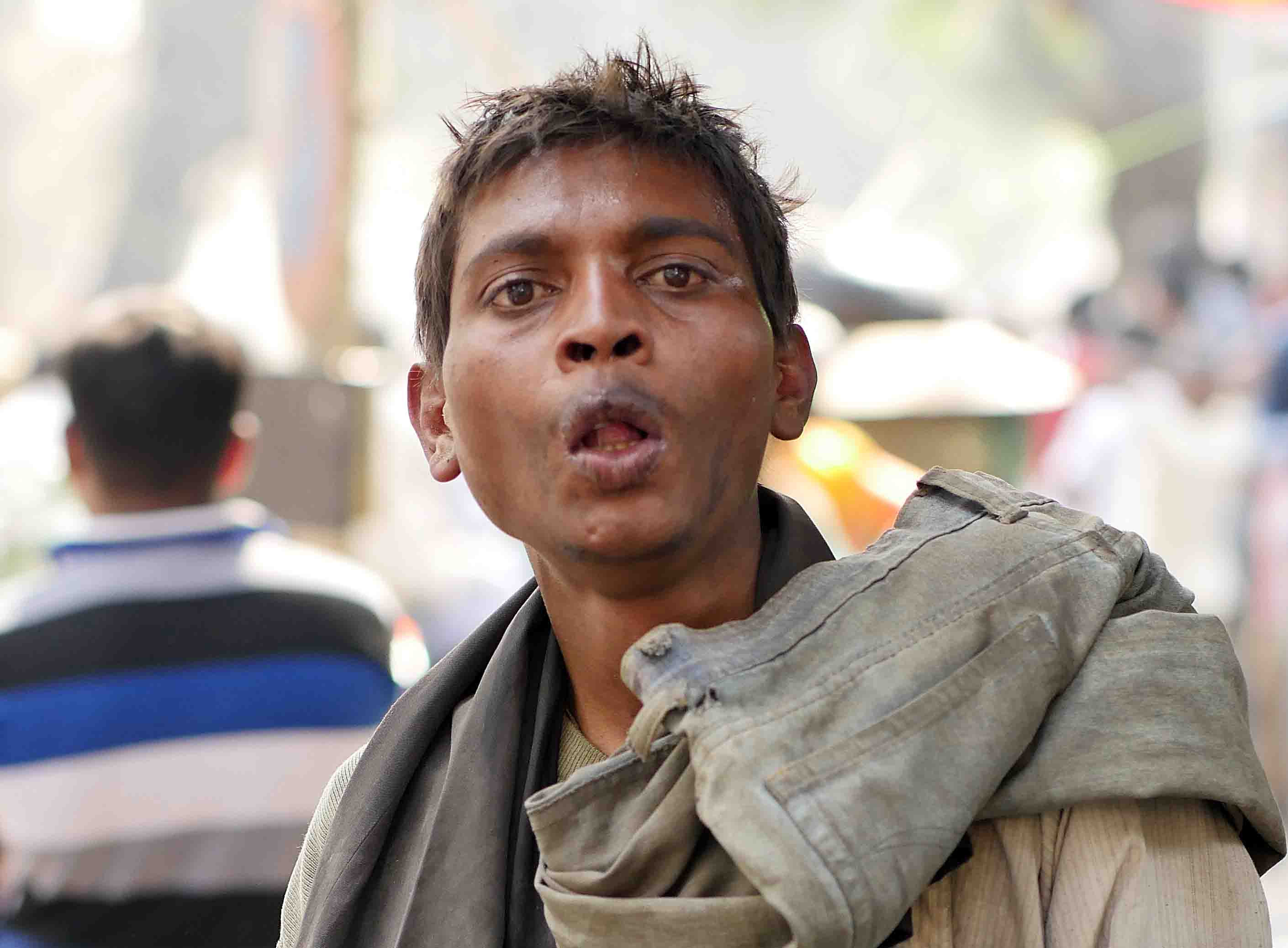 Young untouchable man with a Mentally Disability, Kolkata 2017
