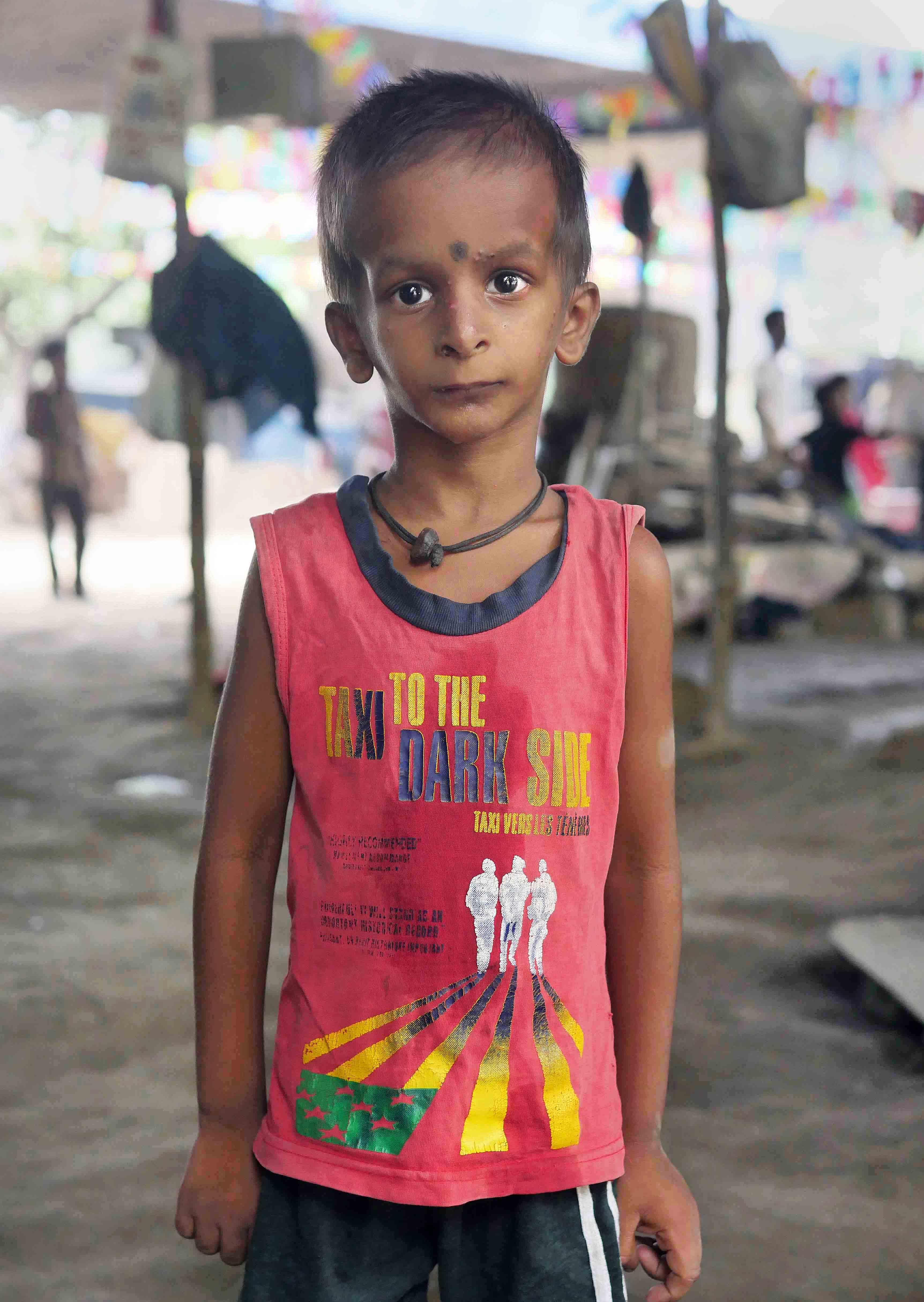 He is small for his age and his head suggests a disability.